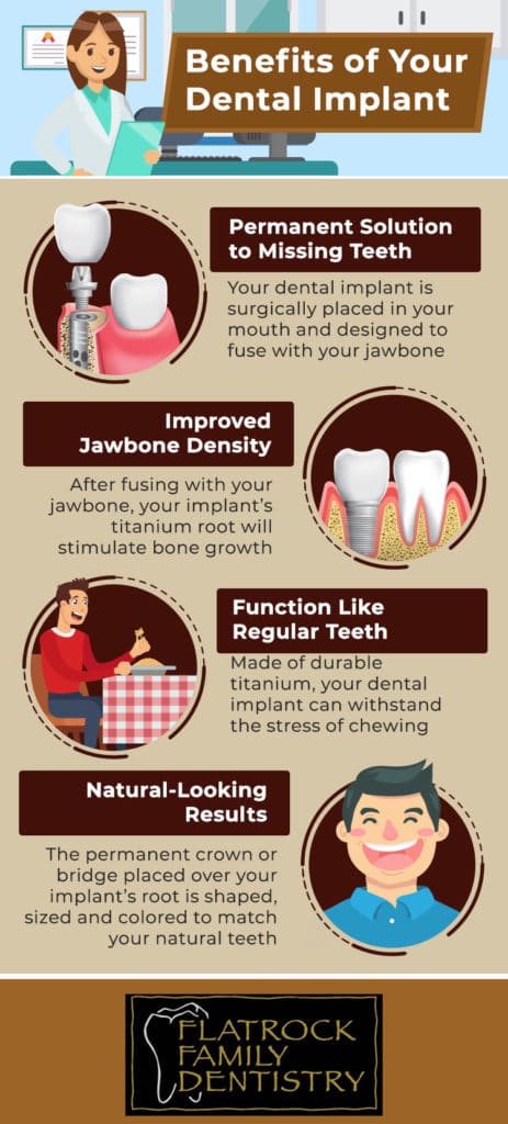 Benefits of dental Implants